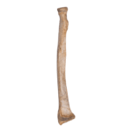 Real Human Radius – Antique
