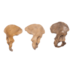 Real Human Hip Bone (Innominate) – Antique (Single)