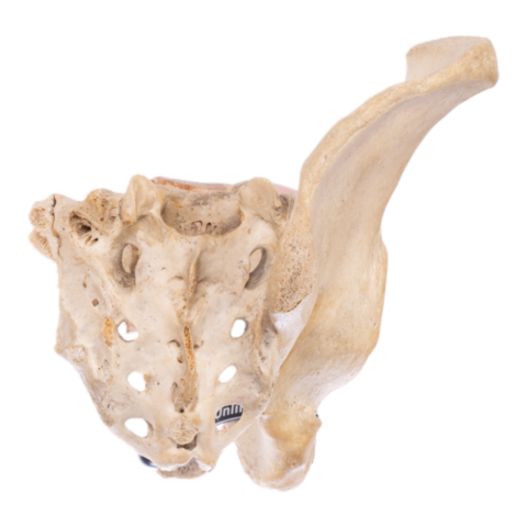 Real Human Hip Bone (Innominate) and Sacrum - Antique