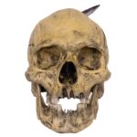 Replica Spanish Conquistador Human with Broad Ax Trauma Skull