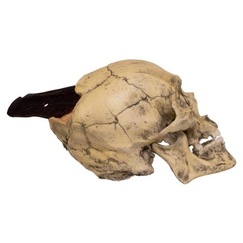 Replica Spanish Conquistador Human with Broad Ax Trauma Skull