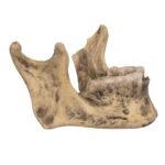Replica Spanish Conquistador Human with Broad Ax Trauma Skull