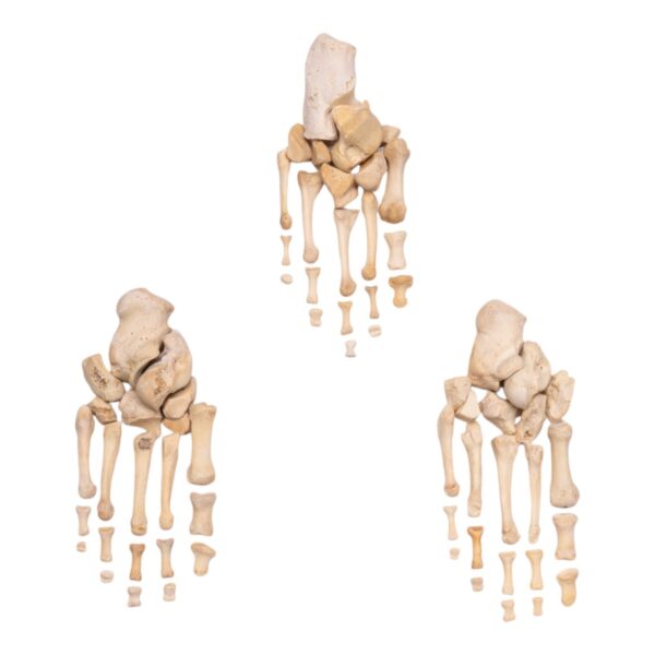 Real Human Foot – Partial Set