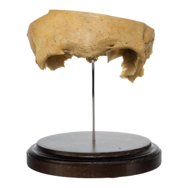 Real Human Partial Frontal Bone on Stand – 178 g