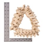 Real Human Spine – Disarticulated