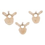 Real Human Thoracic Vertebra – Single