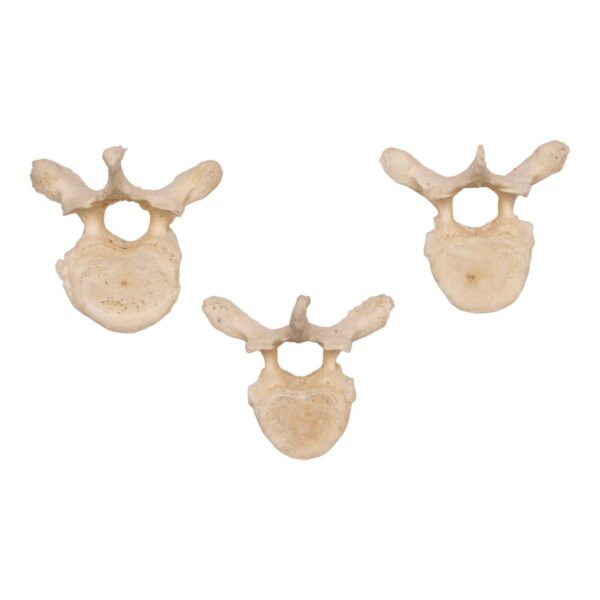 Real Human Thoracic Vertebra – Single
