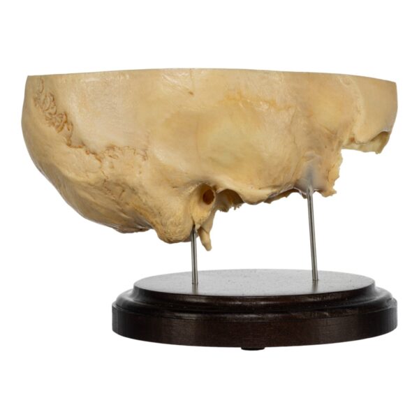 Real Human Partial Skull on Stand – 232 g