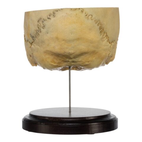 Real Human Partial Skull on Stand - 204 g