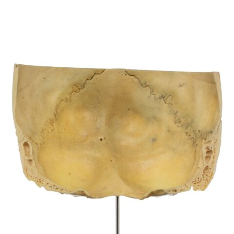 Real Human Partial Skull on Stand - 204 g