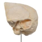 Real Human Partial Skull on Stand – 212 g
