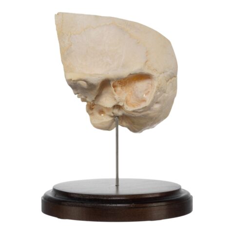 Real Human Partial Skull on Stand - 212 g