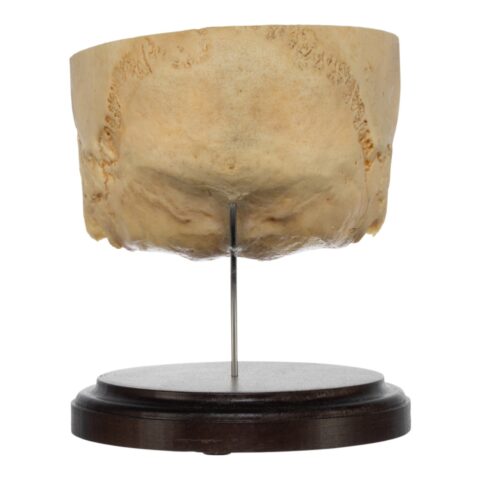 Real Human Partial Skull on Stand - 222 g