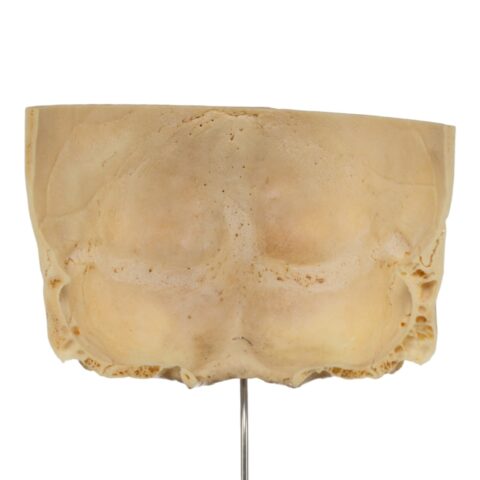 Real Human Partial Skull on Stand - 222 g