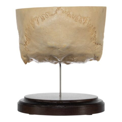Real Human Partial Skull on Stand - 220 g