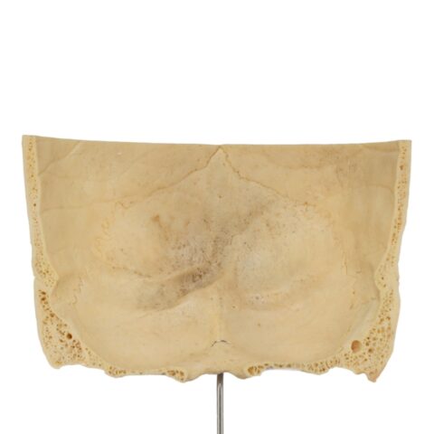 Real Human Partial Skull on Stand - 220 g