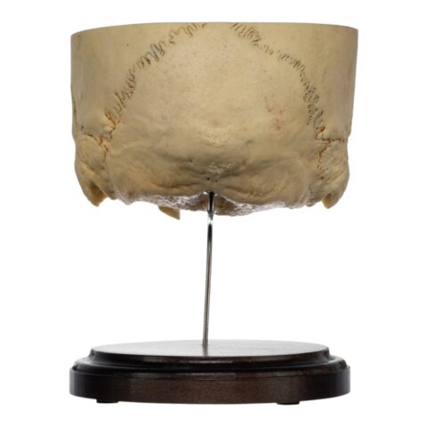 Real Human Partial Skull on Stand - 272 g