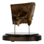 Real Human Partial Skull on Stand – 246 g