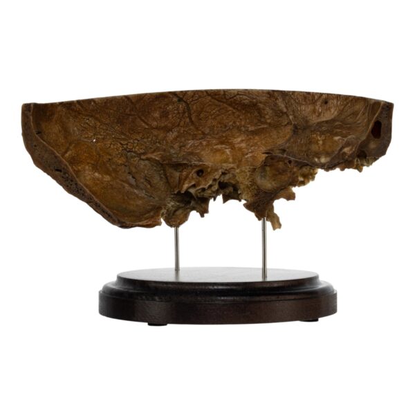 Real Human Partial Skull on Stand – 246 g