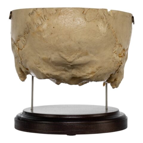 Real Human Partial Skull on Stand - 308 g