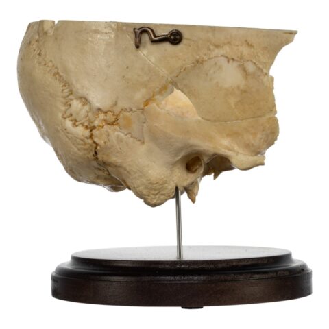 Real Human Partial Skull on Stand - 308 g
