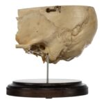 Real Human Partial Skull on Stand – 308 g