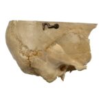 Real Human Partial Skull on Stand – 308 g