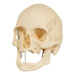 Real Research Quality Human Skeleton – Disarticulated (Pathology)