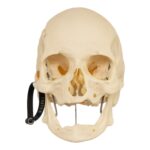 Real Research Quality Human Skeleton – Disarticulated (Pathology)