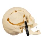 Real Research Quality Human Skeleton – Disarticulated (Pathology)