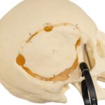 Real Research Quality Human Skeleton – Disarticulated (Pathology)
