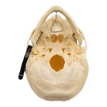 Real Research Quality Human Skeleton – Disarticulated (Pathology)