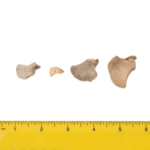 Real Research Quality Human Fetal Scapula – Single