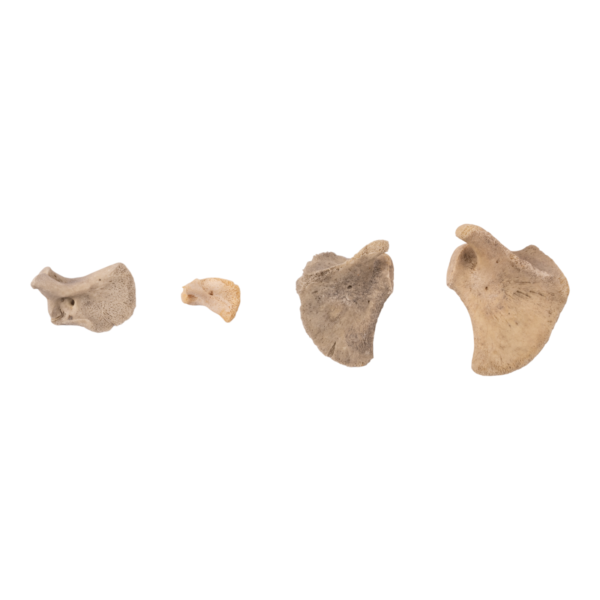 Real Research Quality Human Fetal Scapula – Single