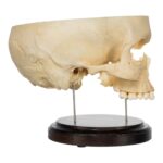 Real Human Partial Skull on Stand – 282 g