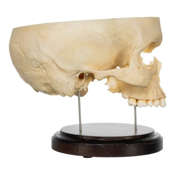 Real Human Partial Skull on Stand – 282 g