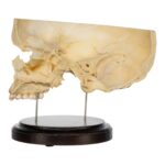 Real Human Partial Skull on Stand – 282 g