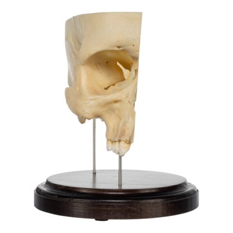 Real Human Partial Skull on Stand - 282 g