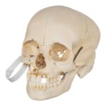 Real Human Child Skull – Damaged