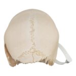 Real Human Child Skull – Damaged