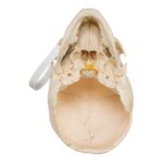 Real Human Child Skull – Damaged