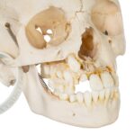 Real Human Child Skull – Damaged