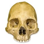 Replica Human Skull – Trephined