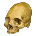 Replica Human Skull – Trephined