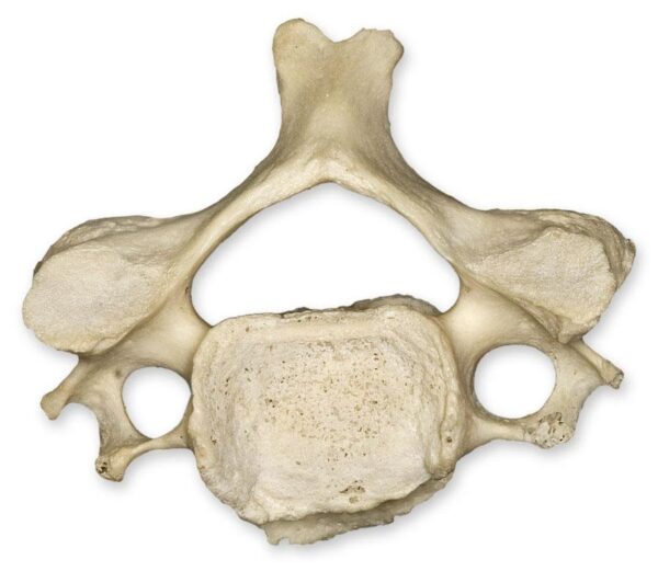 Real Human Cervical Vertebra – Single
