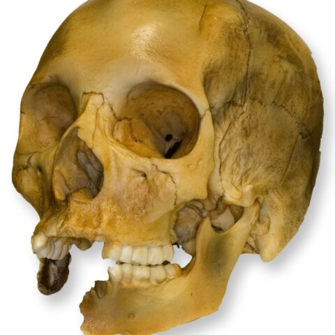 Replica Human Female with Shotgun Wounds Skull