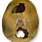 Replica Human Female with Shotgun Wounds Skull